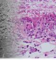 The artificial material (left) combines well with the biomaterial (right) (montage).