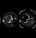 X-ray images of a mouse show: normal X-ray image, phase contrast and darkfield image (fltr). The phase contrast, dark field and absorption images acquired using the new compact synchrotron have complementary properties.