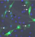 On the left are fluorescence-labeled cells with nanoparticles: The cellular nuclei are shown in blue, the fluorescence labeling is shown in green and the nanoparticles in the cells are identified by arrows. The middle photo shows a blood vessel populated with these cells (green). On the right is a detailed image of a vascular wall with the eNOS protein identified (red).