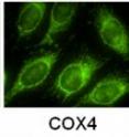These HeLa cells were sequentially stained using antibodies bound to five different cellular proteins. Each staining procedure took 10 minutes with the cyclic solution draining and replenishing method, whereas other methods would need 60 minutes to produce the same level of staining.