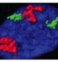 Chromosomes 4 (red) and 18 (green) are noticeably smaller in the nucleus of a senescent cell (right) than in a nonsenescent cell (left).