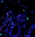 In healthy breast tissue, the percentage of cells expressing molecular marker Ki67 (green) and p27 (red) was low.