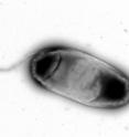 <i>E. coli</i> bacterium visualized by electron microscopy.