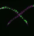 <p>Roundworms (<em>Caenorhabditis elegans</em>) with a disabled <em>eri-1</em> gene can lose their ability to control repetitive DNA. In the absence of <em>eri-1</em>, even two age-matched siblings can look dramatically different. These differences are because of variable expression from high-copy DNA (green) but not from low-copy DNA (magenta) in the worms' intestinal cells. In worms with a functional <em>eri-1</em> gene, even multi-copy DNA is expressed uniformly in all animals. Image credit: Antony Jose (Click image to download hi-res version.)