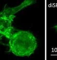 This is a macrophage actin labeled with green fluorescent protein, imaged with the new triSPIM microscope (left) and the diSPIM (right).