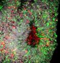 This image shows Zika virus infection in cell death in human forebrain organoids.