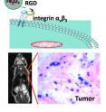 The illustration (top) shows how a RGD peptide-coated iron oxide nanoparticle binds with an integrin-rich tumor cell. At bottom left is a MRI of a mouse with the implanted U87MG tumor (red circle). At bottom right is an optical image that reveals iron oxide nanoparticles (blue) amassed in the tumor area (pink).