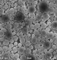 Scanning electron microscope image of polyketal microparticles loaded with the therapeutic enzyme superoxide dismutase, which is used to treat acute liver failure.