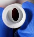 Engineers at Georgia Tech developed the prosthetic vein valve shown here to help improve the lives of those suffering from a condition known as chronic venous insufficiency.
