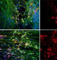 Top: When motor neurons (shown in red) are grown in the presence of defective astrocytes their numbers plummet. Bottom: Treating the cultures with apocynin, a powerful anti-oxidant, dramatically increases the survival of motor neurons.  All cells' nuclei are labeled blue and neurons are shown in green. Right panel: Only motor neurons are shown.