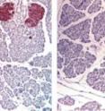 More insulin-positive cells (brown)
occur in mice lacking leptin-making fat
cells (left) than in control mice (right).