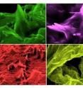 The protruding elements seen in the different slides are cholesterol crystals. Those elements are arising from within the artery wall, causing tearing and damage to the artery. The colors have been added for enhancement and imagery.