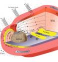 This is a diagram of the Oct. 6, 2008, MESSENGER flyby that revealed magnetic tornadoes forming in Mercury's magnetic field. The tornadoes are corkscrew-shaped bundles of twisted magnetic fields and plasma. The pink area represents the boundary of Mercury's magnetic field, called the magnetopause. The tornadoes are technically known as "flux transfer events" (twisted lines) when they form at the magnetopause and "plasmoids" (yellow areas) when they form in the long magnetic "tail" extending from the night-side of Mercury. The large magnetic field leakage through the magnetopause and the flux transfer events acts as open channels through which the solar wind can flow down to the surface of the planet and sputter neutral atoms into Mercury's atmosphere.