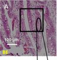 Visible light micrograph of Barrett's esophagus tissue (A) and a synchrotron infrared image (B) from the Canadian Light Source. The light blue area corresponds to an area rich in glycoproteins, a biomarker for Barrett's esophagus
