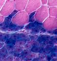 This cross section of hind limb muscle tissue is from a mouse five days after injury. The uninjured cells are at top and stained red. The blue cells below are regenerating muscles cells. They were labeled with a blue stain and formed from muscle stem cells.