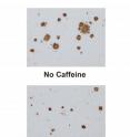 Caffeine treatment removed the beta amyloid plaques from the brains of the Alzheimer's mice. Caffeine treatment removed the beta amyloid plaques from the brains of the Alzheimer's mice.