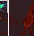 With glutamate stimulation (right), CaV1.2 channels (red) are internalized and degraded by cortical neurons under PIKfyve's direction. With glutamate stimulation (right), CaV1.2 channels (red) are internalized and degraded by cortical neurons under PIKfyve's direction.