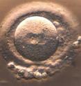 This is a fertilized human egg, prior to division. Two nuclei (one from the egg and one from the sperm) can be seen in the center.