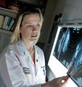 Breast surgeon Julie Margenthaler, M.D., looks at a mammogram. Margenthaler was one of the lead investigators in a nationwide trial that tested how estrogen-lowering drugs before breast cancer surgery affected surgical outcomes.