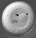 Left: This is a Spisula surf clam egg cell. The nucleolinus (arrowhead) is within the nucleolus (arrow), and both are contained in the nucleus (GV). Middle: When the nucleolus is damaged with a laser, normal cell division takes place. Right: When the nucleolinus is damaged with a laser, cell division structures (blue and yellow) appear as a disorganized cluster, and cell division fails.