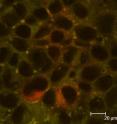 This figure shows 50 nm carboxylated polystyrene nanoparticles (green) interacting with a cell culture model of the intestinal epithelium (red). Oral exposure to these particles was shown to affect iron transport.