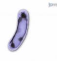 This is an example of magnetotactic bacteria. You can see the magnetic particles on the left side of the cell.