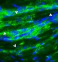 Treatment with stem cells derived from blood vessels spurred nestin-positive stem cells already present in the heart to form new cardiac muscle cells (see arrows).