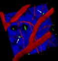 This is a false color image of the skin showing newly discovered immune cells, which have a potential link to allergic skin diseases like eczema. Red = blood vessels, Blue = collagen, black holes = hair follicles (with green hairs). Newly discovered cells are in green.