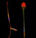 Scientists at the Scripps Research Institute have found a simple way to turn bone marrow stem cells directly into brain precursor cells, such as those shown here.