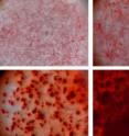 Silicate nanoplatelets cause stem cells to become bone cells, as determined by the formation of bone matrix (in red).