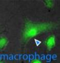 These are images of B cells (left, red arrowheads), progenitor cells (center, black arrowhead), and macrophages (right, blue arrowhead) taken from a time-lapse movie of differentiating cells in culture. The brightness of green indicates the amount of the regulatory protein PU.1 present.