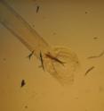 This is the back of the <i>Haemonchus contortus</i> (Barber Pole) worm.