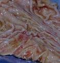 These are <i>Haemonchus contortus</i> (Barber Pole) worms in situ in a sheep gut.