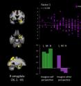 This is response in the right amygdala across groups of low (L), medium (M) and high (H) psychopathy  participants, when they adopted an imagine-self and an imagine-other affective perspective while viewing bodily injuries. 

Groupwise effects (bars at the bottom of the figure) are expanded to show the contribution of continuous PCL-R subscores on factor 1, which encompasses the emotional/interpersonal features of psychopathy.