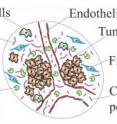 Small clusters of young tumor cells around blood vessels produce signature peptides (small pink lines). Some of these peptides move into the bloodstream -- where they can be detected by a serum-based tool currently in development.