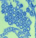 This is an electron micrograph showing the 2009 H1N1 virus.