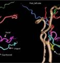 These images show CT angiography before and after face transplantation.
The donor's facial artery (yellow) was successfully anastomosed or reconnected to the recipient's vessel.