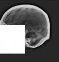This X-ray image shows the cranial vault outline of a skull. A recent study from NC State forensic anthropologists found that even forensic experts have a hard time making a positive identification of human remains based on the shape of the vault outline. This X-ray image shows the cranial vault outline of a skull. A recent study from NC State forensic anthropologists found that even forensic experts have a hard time making a positive identification of human remains based on the shape of the vault outline.