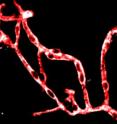 Studies in mice showed how brain blood vessel cells called pericytes (white) may contribute to the problems associated with Alzheimer's disease. Studies in mice showed how brain blood vessel cells called pericytes (white) may contribute to the problems associated with Alzheimer's disease.
