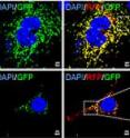 Mitochondria in hepatitis C-infected cells (bottom row) are self-destructing. The self-annihilation process explains the persistance and virulence of the virus in human liver cells. Mitochondria in hepatitis C-infected cells (bottom row) are self-destructing. The self-annihilation process explains the persistance and virulence of the virus in human liver cells.