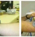 This shows the new glucose- and dehydration-monitoring "watch," strapped to a subject's wrist and connected to a computer for readout.