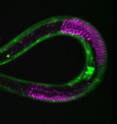 This shows the nematode worm <i>C. elegans</i> with muscle cells fluorescently labeled in green and germ cells fluorescently labeled in red. These cells and others pause at a checkpoint in development and slow their aging when worms encounter a period of starvation.