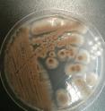 This is a photo of the fungus <em>Aspergillus versicolor</em>.