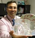 'The good news is that Ontarians are receiving very good stroke care overall,' said Dr. Gustavo Saposnik, lead author of the study and director of the Stroke Research Unit of St. Michael's Hospital. 'But there are still things we can do to help patients receive better quality, long-term care after a stroke. And the first thing on that list is giving each patient a prescription before he or she leaves as part of discharge planning.' 'The good news is that Ontarians are receiving very good stroke care overall,' said Dr. Gustavo Saposnik, lead author of the study and director of the Stroke Research Unit of St. Michael's Hospital. 'But there are still things we can do to help patients receive better quality, long-term care after a stroke. And the first thing on that list is giving each patient a prescription before he or she leaves as part of discharge planning.'