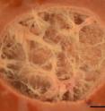 This is a cross section through a histotripsy lesion created in bovine liver tissue with the liquified cellular contents washed out revealing the remaining extracellular matrix. The scale bar represents 5mm.