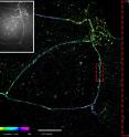This image depicts superresolution imaging of E-cadherin at the cell membrane. Conventional microscopy (white box) shows E-cadherin as a belt along the cell membrane. Superresolution imaging reveals that E-cadherin assembles as distinct, punctate clusters. This image depicts superresolution imaging of E-cadherin at the cell membrane. Conventional microscopy (white box) shows E-cadherin as a belt along the cell membrane. Superresolution imaging reveals that E-cadherin assembles as distinct, punctate clusters.