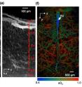 These images show fast functional photoacoustic microscopy of the mouse brain. Figure (d, left) shows a representative x-y projected brain vasculature image through an intact skull. Figure (e) shows a representative enhanced x-z projected brain vasculature image. Figure (f) shows photoacoustic microscopy of oxygen saturation of hemoglobin in the mouse brain, acquired by using the single-wavelength pulse-width0based method with two lasers.