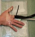 Researchers prepare a study participant's finger for joint cracking under the watch of an MRI video setup at the Peter S. Allen MR Research Centre, University of Alberta.
