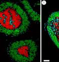 Sections of the bacteriome in two types of cicadas, <em>Tettigades</em> (left) and <em>Magicicada</em>, with <em>Hodgkinia</em> stained red and another bacteria, <em>Sulcia</em> stained green.