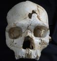 This is a frontal view of Cranium 17 showing the position of the traumatic events T1 (inferior) and T2 (superior).